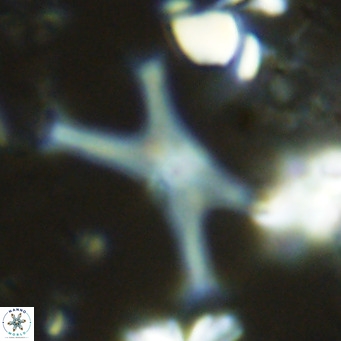 Discoaster pseudosurculus VR 08249