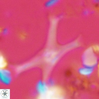 Discoaster pseudosurculus VR 08254