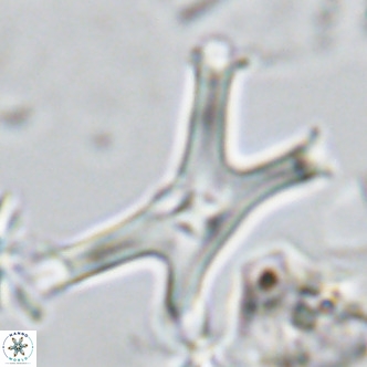 Discoaster pseudosurculus VR 08256