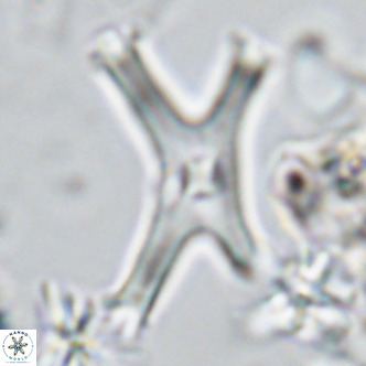 Discoaster pseudosurculus VR 08257