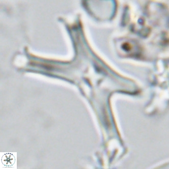 Discoaster pseudosurculus VR 08258