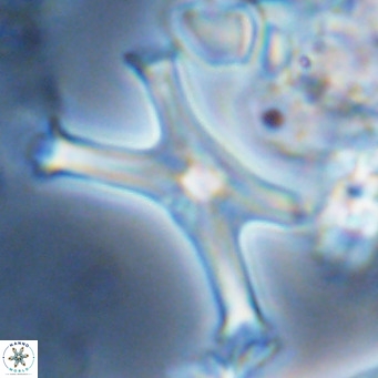 Discoaster pseudosurculus VR 08259