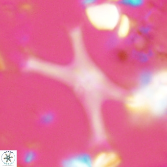 Discoaster pseudosurculus VR 08250