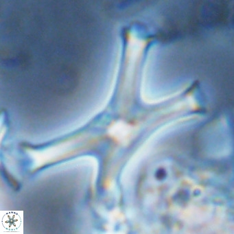 Discoaster pseudosurculus VR 08261