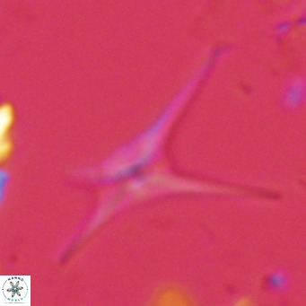 Discoaster quadramus VR 07519