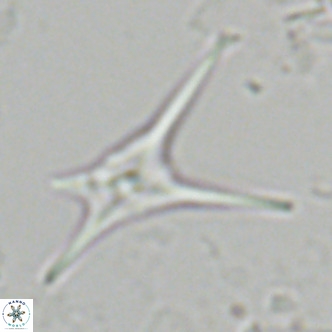 Discoaster quadramus VR 07521