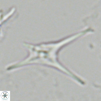 Discoaster quadramus VR 07522