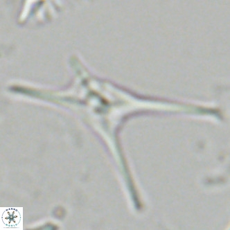 Discoaster quadramus VR 07523