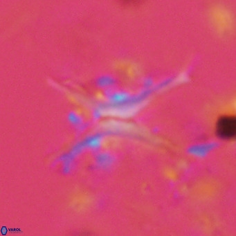 Discoaster quadramus VR 09206