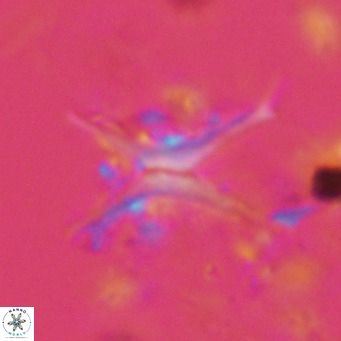 Discoaster quadramus VR 09206