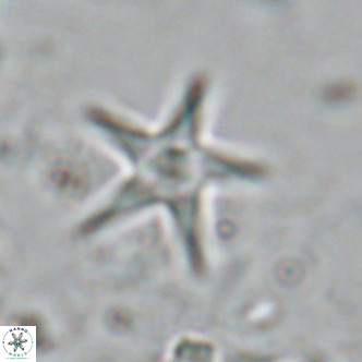 Discoaster quintatus VR 07412