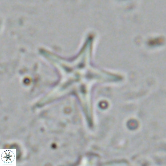 Discoaster quintatus VR 07413