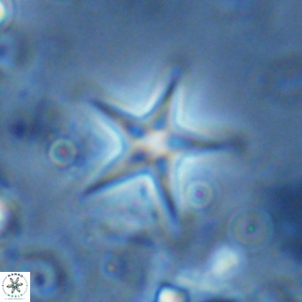Discoaster quintatus VR 07415