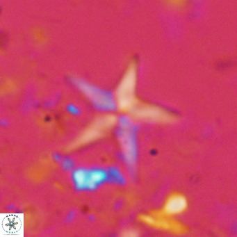 Discoaster quintatus VR 07418