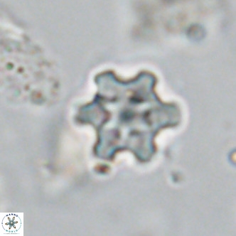 Discoaster stellimicros VR 18586