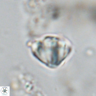 Discoaster stellimicros VR 18589