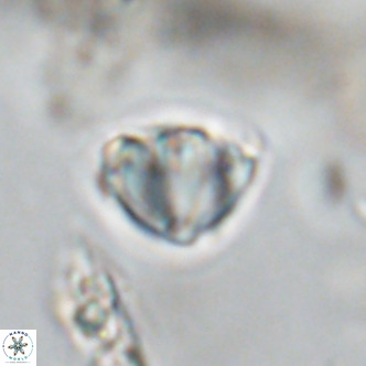 Discoaster stellimicros VR 18590