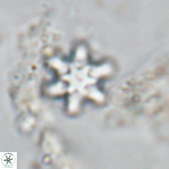 Discoaster stellimicros VR 18592