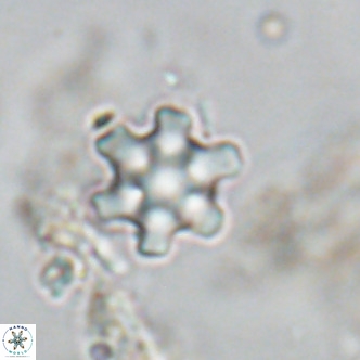 Discoaster stellimicros VR 18593