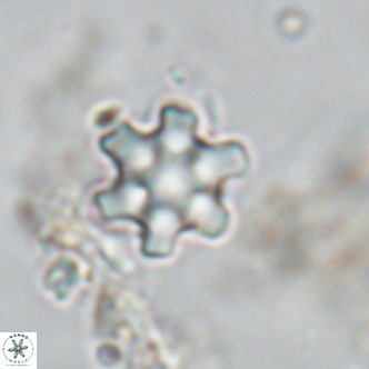 Discoaster stellimicros VR 18595
