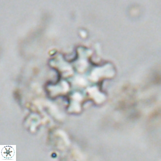 Discoaster stellimicros VR 18596