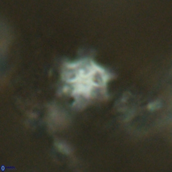 Discoaster stellimicros VR 18598