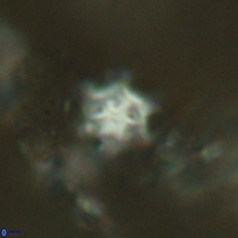 Discoaster stellimicros VR 18601