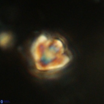 Discoaster stellimicros VR 18602