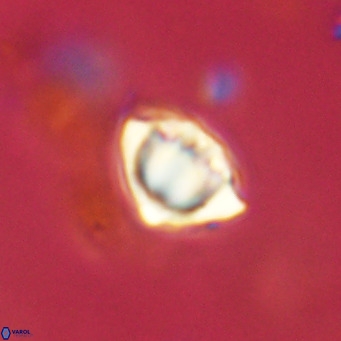 Discoaster stellimicros VR 18607