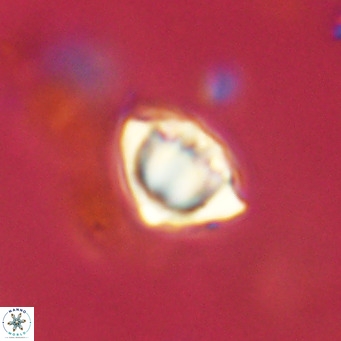 Discoaster stellimicros VR 18607