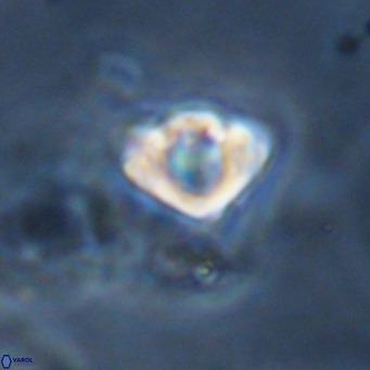 Discoaster stellimicros VR 18614