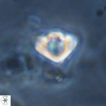 Discoaster stellimicros VR 18614