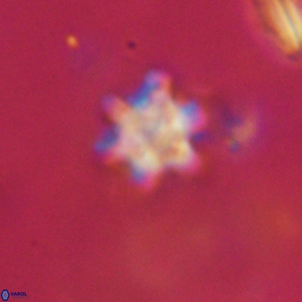 Discoaster stellimicros VR 18622