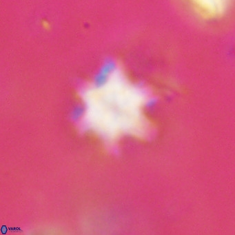 Discoaster stellimicros VR 18624