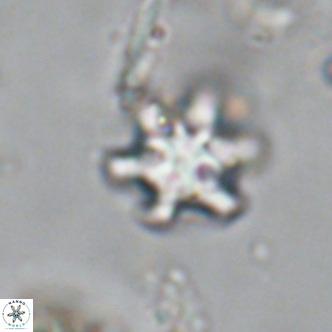 Discoaster stellimicros VR 18995