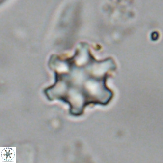 Discoaster stellimicros VR 18998