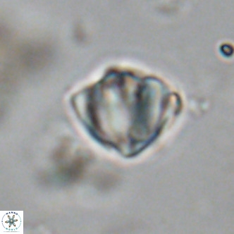 Discoaster stellimicros VR 19006