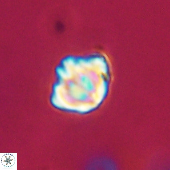 Discoaster stellimicros VR 19212
