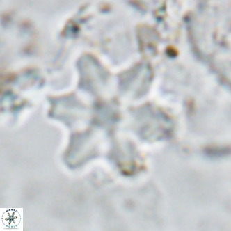 Discoaster stellulus VR 10143