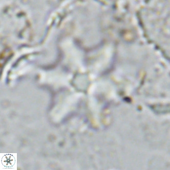 Discoaster stellulus VR 10130