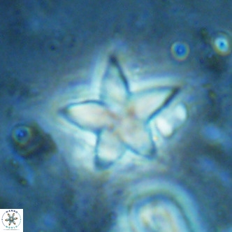 Discoaster sublodoensis VR 02385