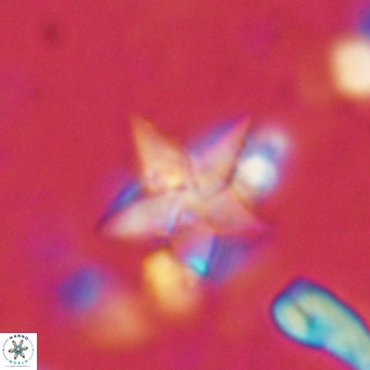 Discoaster sublodoensis VR 02390
