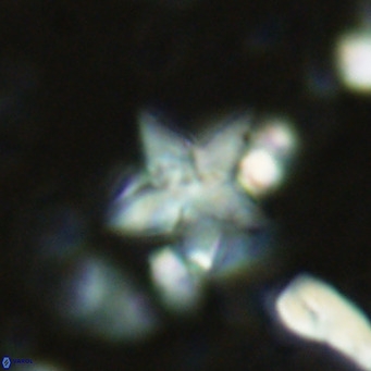 Discoaster sublodoensis VR 02391