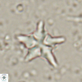 Discoaster sublodoensis VR 025580
