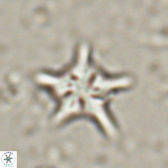 Discoaster sublodoensis VR 025581