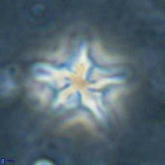 Discoaster sublodoensis VR 025586