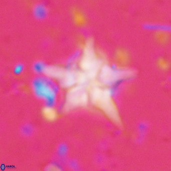 Discoaster sublodoensis VR 025589