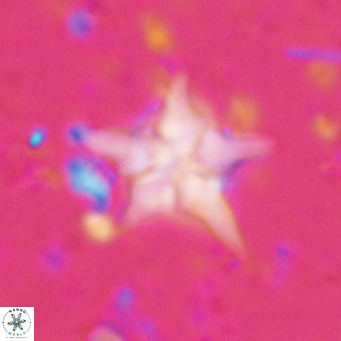 Discoaster sublodoensis VR 025589