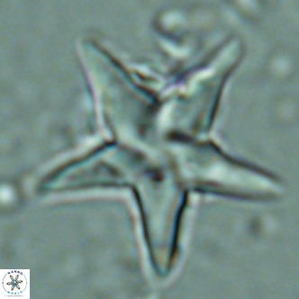 Discoaster sublodoensis VR 02588
