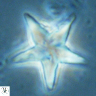 Discoaster sublodoensis VR 02590
